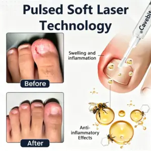 Cavebit® NailFungiClear Pro Antifungal Pen